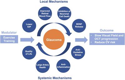 High-intensity interval training in patients with glaucoma (HIT-GLAUCOMA): protocol for a multicenter randomized controlled exercise trial